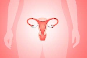 Endometriose e Fertilidade