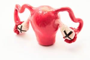 Infertilidade: O Fator Ovariano